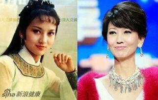 赵雅芝吃的什瓜,揭秘养生与美味的完美融合